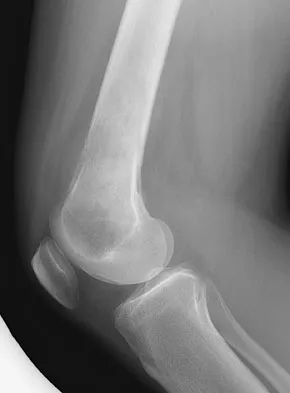 General Orthopedics 2026 Practice Questions: Set 19 (Solved) - Figure 29
