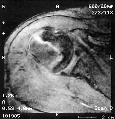 General Orthopedics 2026 Practice Questions: Set 19 (Solved) - Figure 32