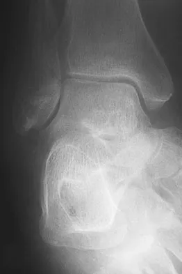 General Orthopedics 2026 Practice Questions: Set 19 (Solved) - Figure 35