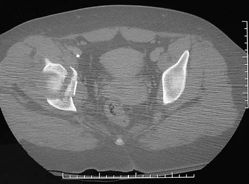 General Orthopedics 2026 Practice Questions: Set 19 (Solved) - Figure 39