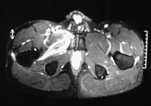 General Orthopedics 2026 Practice Questions: Set 19 (Solved) - Figure 44