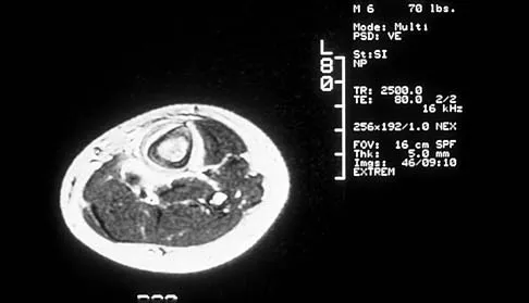 General Orthopedics 2026 Practice Questions: Set 19 (Solved) - Figure 46