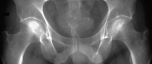 General Orthopedics 2026 Practice Questions: Set 19 (Solved) - Figure 56