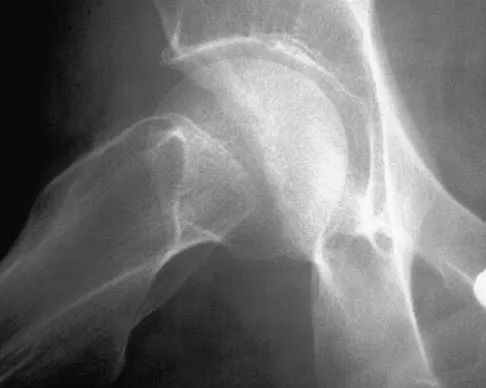 General Orthopedics 2026 Practice Questions: Set 19 (Solved) - Figure 57