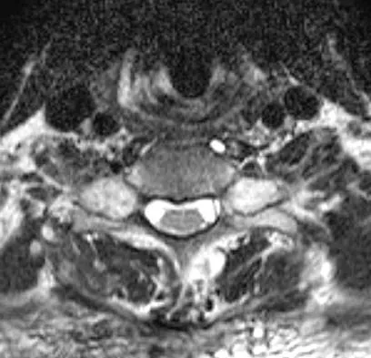 General Orthopedics 2026 Practice Questions: Set 19 (Solved) - Figure 63