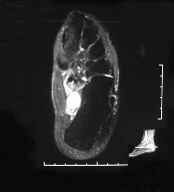 General Orthopedics 2026 Practice Questions: Set 19 (Solved) - Figure 65