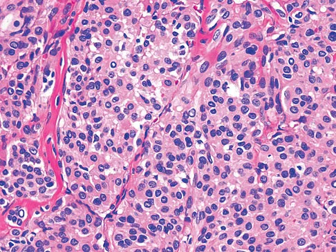General Orthopedics 2026 Practice Questions: Set 19 (Solved) - Figure 69