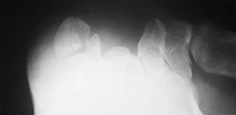 General Orthopedics 2026 Practice Questions: Set 19 (Solved) - Figure 7