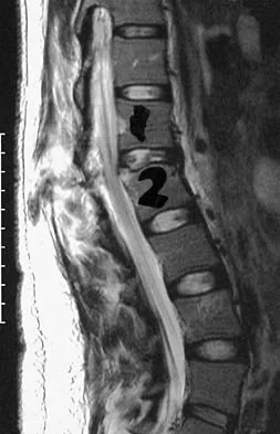 General Orthopedics 2026 Practice Questions: Set 19 (Solved) - Figure 73