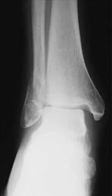 General Orthopedics 2026 Practice Questions: Set 19 (Solved) - Figure 75