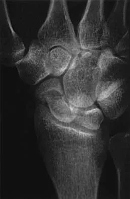 General Orthopedics 2026 Practice Questions: Set 19 (Solved) - Figure 77