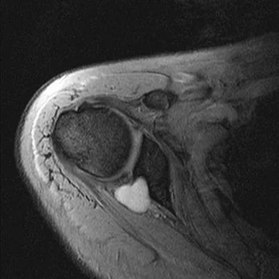 General Orthopedics 2026 Practice Questions: Set 19 (Solved) - Figure 79