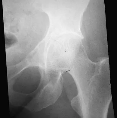 General Orthopedics 2026 Practice Questions: Set 19 (Solved) - Figure 82