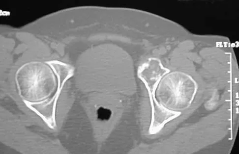 General Orthopedics 2026 Practice Questions: Set 19 (Solved) - Figure 83