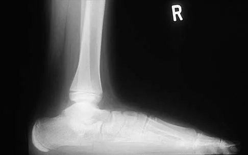 General Orthopedics 2026 Practice Questions: Set 19 (Solved) - Figure 89