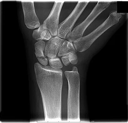 General Orthopedics 2026 Practice Questions: Set 19 (Solved) - Figure 92