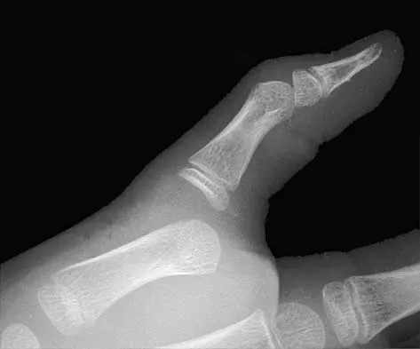 General Orthopedics 2026 Practice Questions: Set 19 (Solved) - Figure 95