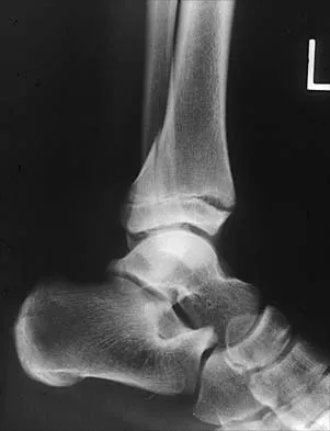 General Orthopedics Board Review 2026: High-Yield MCQs (Set 2) - Figure 1