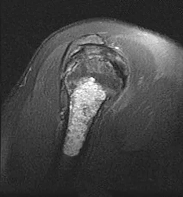 General Orthopedics Board Review 2026: High-Yield MCQs (Set 2) - Figure 111