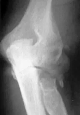 Click to enlarge General Orthopedics Board Review 2026: High-Yield MCQs (Set 2) - Figure 119