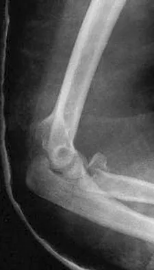 Click to enlarge General Orthopedics Board Review 2026: High-Yield MCQs (Set 2) - Figure 120