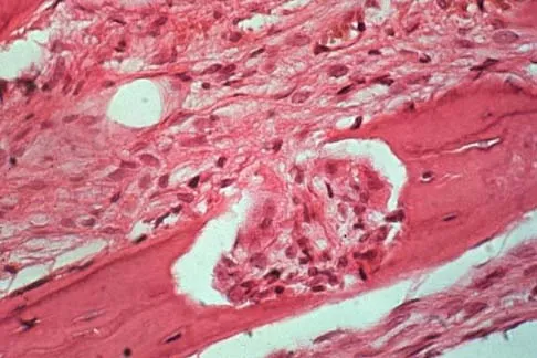 General Orthopedics Board Review 2026: High-Yield MCQs (Set 2) - Figure 130