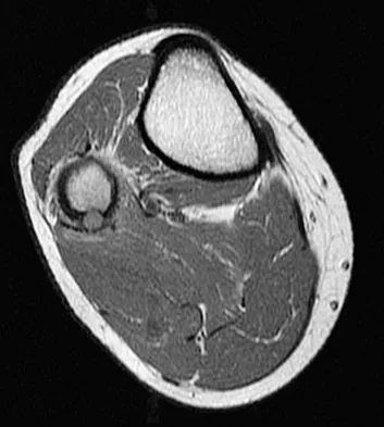 General Orthopedics Board Review 2026: High-Yield MCQs (Set 2) - Figure 133