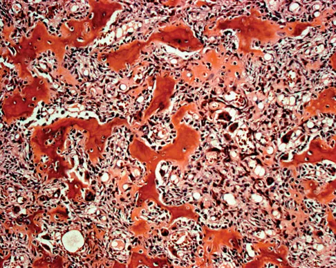 General Orthopedics Board Review 2026: High-Yield MCQs (Set 2) - Figure 135