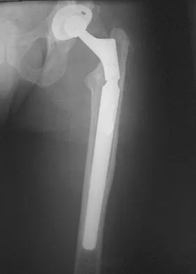 General Orthopedics Board Review 2026: High-Yield MCQs (Set 2) - Figure 139