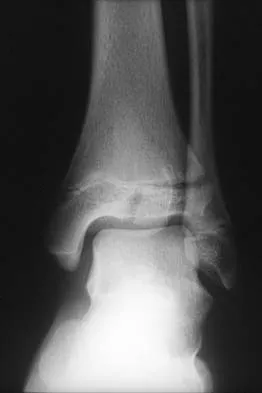 General Orthopedics Board Review 2026: High-Yield MCQs (Set 2) - Figure 2