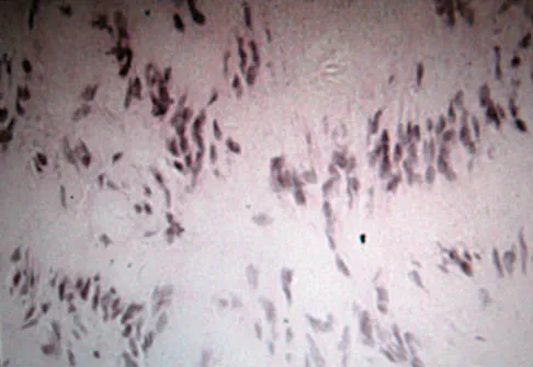 General Orthopedics Board Review 2026: High-Yield MCQs (Set 2) - Figure 20