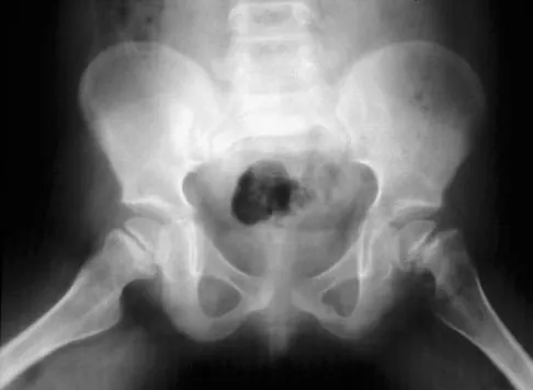 General Orthopedics Board Review 2026: High-Yield MCQs (Set 2) - Figure 22