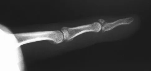 General Orthopedics Board Review 2026: High-Yield MCQs (Set 2) - Figure 26