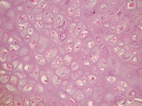 General Orthopedics Board Review 2026: High-Yield MCQs (Set 2) - Figure 32