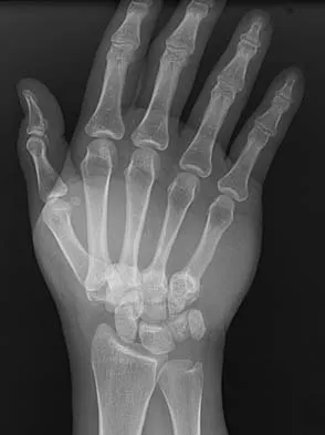 General Orthopedics Board Review 2026: High-Yield MCQs (Set 2) - Figure 35