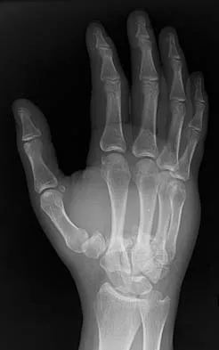 General Orthopedics Board Review 2026: High-Yield MCQs (Set 2) - Figure 36