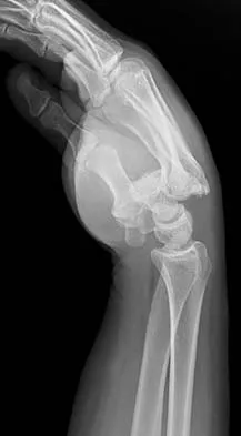 General Orthopedics Board Review 2026: High-Yield MCQs (Set 2) - Figure 37