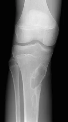 General Orthopedics Board Review 2026: High-Yield MCQs (Set 2) - Figure 38
