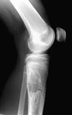 General Orthopedics Board Review 2026: High-Yield MCQs (Set 2) - Figure 39