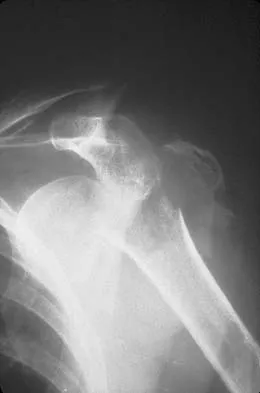 General Orthopedics Board Review 2026: High-Yield MCQs (Set 2) - Figure 44