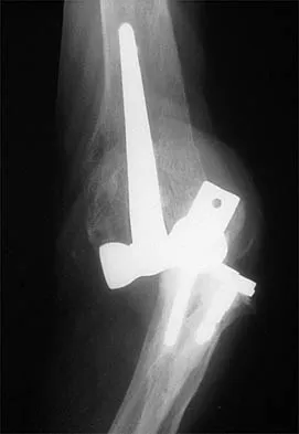 General Orthopedics Board Review 2026: High-Yield MCQs (Set 2) - Figure 45