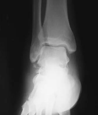 General Orthopedics Board Review 2026: High-Yield MCQs (Set 2) - Figure 49