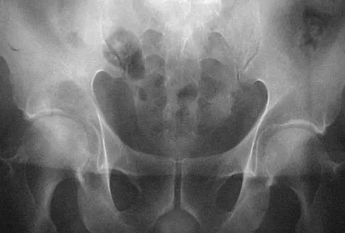 General Orthopedics Board Review 2026: High-Yield MCQs (Set 2) - Figure 55