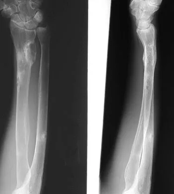 General Orthopedics Board Review 2026: High-Yield MCQs (Set 2) - Figure 57