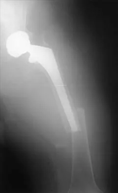 Click to enlarge General Orthopedics Board Review 2026: High-Yield MCQs (Set 2) - Figure 59