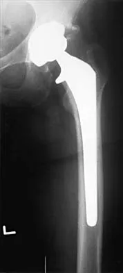 Click to enlarge General Orthopedics Board Review 2026: High-Yield MCQs (Set 2) - Figure 60
