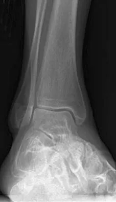 General Orthopedics Board Review 2026: High-Yield MCQs (Set 2) - Figure 69