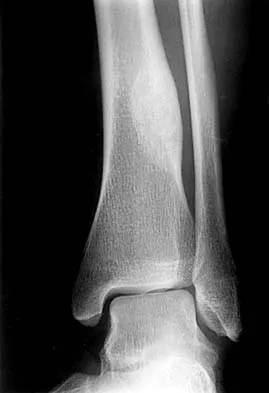 Orthopedic MCQs: Master the Cord of the Brachial & Anatomy