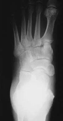 General Orthopedics Board Review 2026: High-Yield MCQs (Set 2) - Figure 80