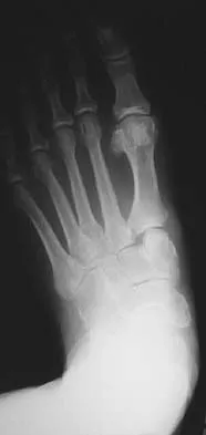 General Orthopedics Board Review 2026: High-Yield MCQs (Set 2) - Figure 82